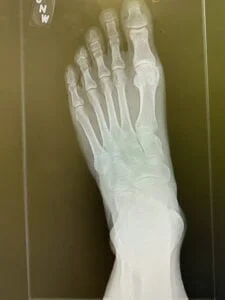 X-Ray Top View