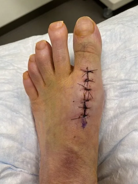 Detail Stitched Foot
