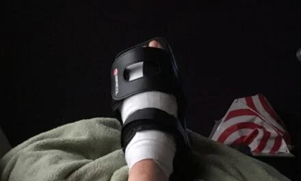 Hallux Limitus – Part 2 – Cheilectomy Surgery!